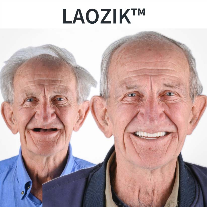 🌟Vásárolj 1 kapsz 1 ingyen😮 Arcmegereszkedést okozó fogsorok? EZ A készlet megállítja (fogorvosok által jóváhagyott!)