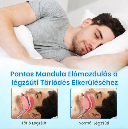 🎁Vásárolj 1 kapsz 1 ingyen😴Horkolásgátló szájbetét – Csökkentse a horkolást már az első éjszakától! 🛏️CPAP/MAD Alternatíva – 180 Napos Garancia!（副本）