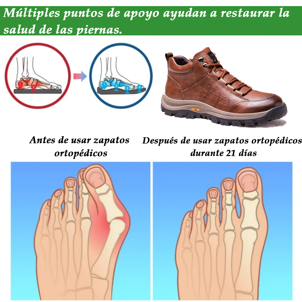 (🔥50% de descuento hoy - ¡no te lo pierdas!) - Zapatos de piel de becerro italiana suaves y cómodos - soporte de arco para aliviar el dolor (también disponible en felpa 🔥)